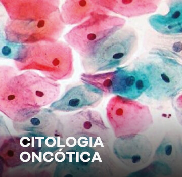 Citologia Oncótica
